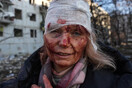 ukraine wounded woman