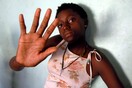 Η Ζιμπάμπουε έγινε η πρώτη αφρικανική χώρα που ενέκρινε φάρμακο πρόληψης του HIV