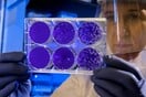 Βρέθηκαν «χαμένα» βακτήρια στα δόντια του Νεάντερταλ – Ελπίδες για ανάπτυξη νέων αντιβιοτικών