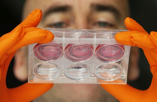 Νέο τεστ αίματος ανιχνεύει όχι μόνο τον καρκίνο, αλλά και πού αυτός αναπτύσσεται