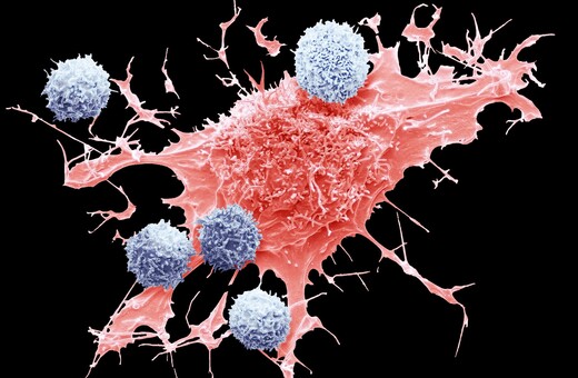 Τα σημάδια του καρκίνου θα μπορούσαν να εντοπιστούν χρόνια πριν από τα συμπτώματα, δείχνει νέα έρευνα