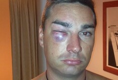 Ξυλοδαρμό και ληστεία από αστυνομικούς στα Χανιά καταγγέλλει Νεοζηλανδός