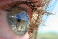 Τυφλοί ξαναβλέπουν χάρη σε βιονικό εμφύτευμα