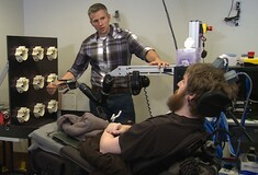 Για πρώτη φορά αίσθηση αφής στο ρομποτικό χέρι άντρα με παράλυση