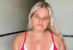 Woman who can’t smile due to rare condition signs with modeling agency