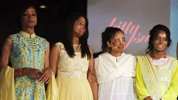 Γυναίκες που δέχθηκαν επίθεση με οξύ σε επίδειξη μόδας στην Ινδία - ΒΙΝΤΕΟ