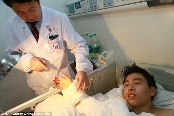 Κινέζος έζησε με το χέρι του προσκολλημένο στον αστράγαλο για ένα μήνα ώστε να γλιτώσει τον ακρωτηριασμό