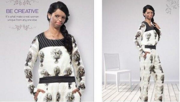Μία γυναίκα - θύμα επίθεσης με οξύ γίνεται η πρώτη εκπρόσωπος ενός μεγάλου οίκου μόδας