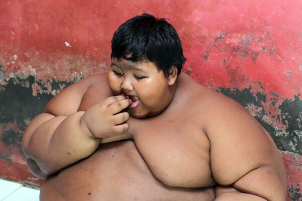 Η δραματική ζωή του πιο παχύσαρκου 10χρονου στον κόσμο