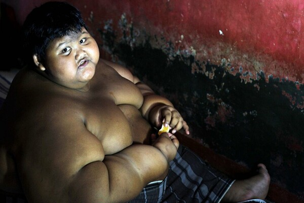 Η δραματική ζωή του πιο παχύσαρκου 10χρονου στον κόσμο