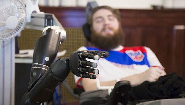 Για πρώτη φορά αίσθηση αφής στο ρομποτικό χέρι άντρα με παράλυση