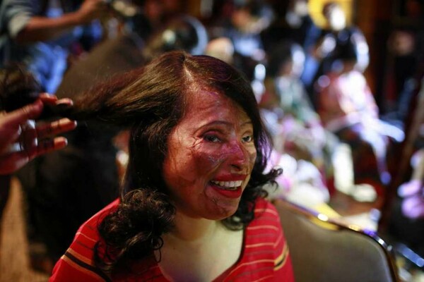 15 γυναίκες που δέχτηκαν επίθεση με οξύ συμμετέχουν σε επίδειξη μόδας στη Ντάκα