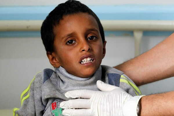 Η Unicef προειδοποιεί: 300.000 κρούσματα χολέρας στην Υεμένη μέχρι το τέλος του καλοκαιριού