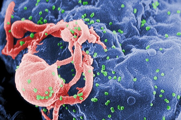 Ένα νέο «σούπερ-αντίσωμα» επιτίθεται στο 99% των στελεχών του ιού HIV