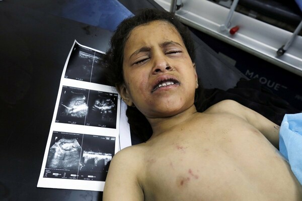 Η Σαουδική Αραβία διαψεύδει έκθεση του ΟΗΕ για εκατοντάδες παιδιά που σκοτώθηκαν στις ένοπλες συρράξεις