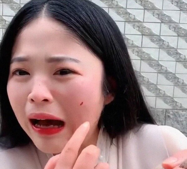 Food blogger δημοσιεύει βίντεο με χταπόδι που της επιτέθηκε όταν πήγε να το φάει