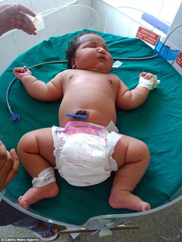Iνδή γέννησε το πιο βαρύ κοριτσάκι του κόσμου
