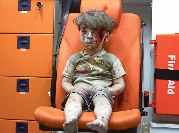 Ο αδελφός του μικρού Ομράν, πέθανε στο νοσοκομείο στο Χαλέπι