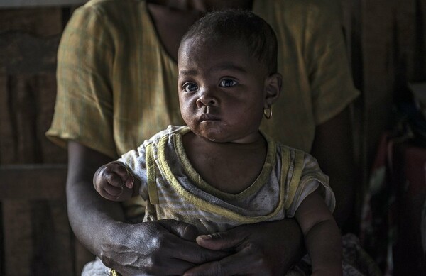 UNICEF: 69 εκατομμύρια παιδιά θα πεθάνουν έως το 2030 από κάτι που μπορεί να προληφθεί
