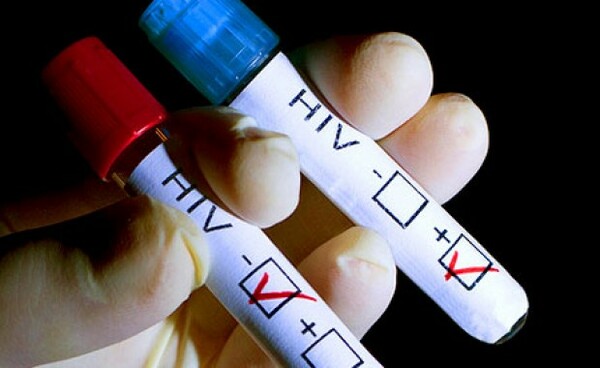 Ευρωπαϊκή Εβδομάδα Εξέτασης για HIV και ηπατίτιδα- Δωρεάν εξετάσεις σε Αθήνα και Θεσσαλονίκη