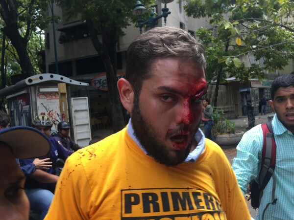 Στο «κόκκινο» η ένταση στη Βενεζουέλα: Βίαια επεισόδια μεταξύ των δυνάμεων ασφαλείας και διαδηλωτών στο Καράκας