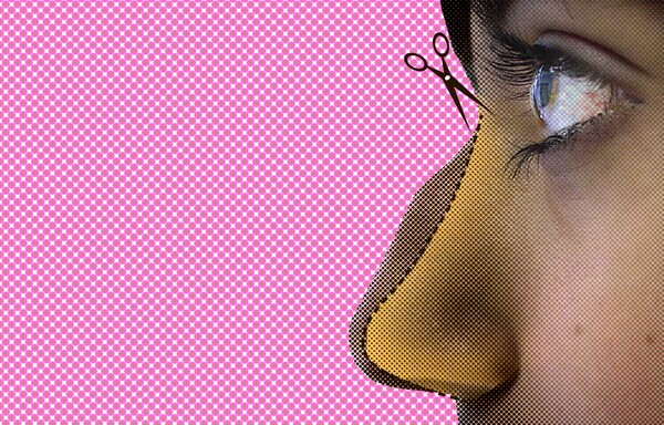 7 πράγματα που θα ευχόμουν να γνωρίζω πριν κάνω πλαστική στη μύτη