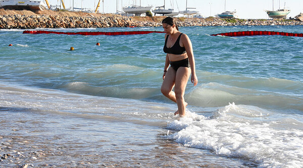 H 38χρονη Δέσποινα είναι η γυναίκα που έγινε διάσημη από τη φωτογραφία με την πίσσα κολλημένη πάνω στο σώμα της