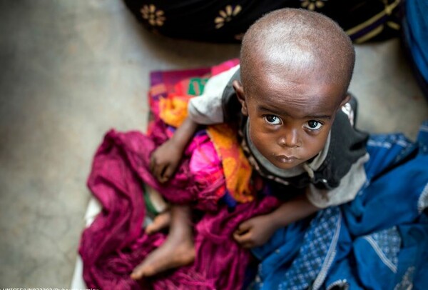 Πάνω από 400.000 παιδιά κάτω των 5 ετών στη ΛΔ Κονγκό υποφέρουν από οξύ υποσιτισμό