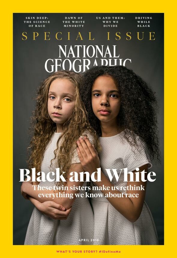 Αυτά τα δίδυμα κορίτσια, η μία λευκή η άλλη μαύρη, επαναπροσδιορίζουν την έννοια της φυλής