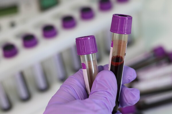 Έρευνα:Σχεδόν το 80% των ανθρώπων έχουν πλαστικά σωματίδια στο αίμα τους