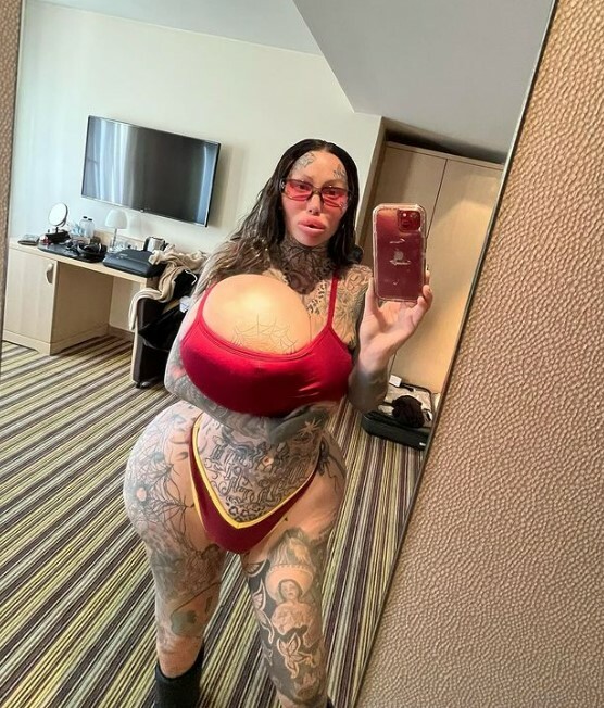 Μοντέλο του Instagram αποκάλυψε ότι το 38J εμφύτευμα στήθους της έσκασε