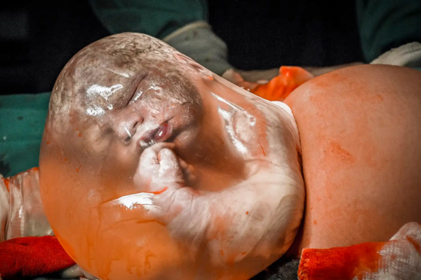 Birth Photography Image Competition: Οι νικητές του διαγωνισμού για τις φωτογραφίσεις γέννας