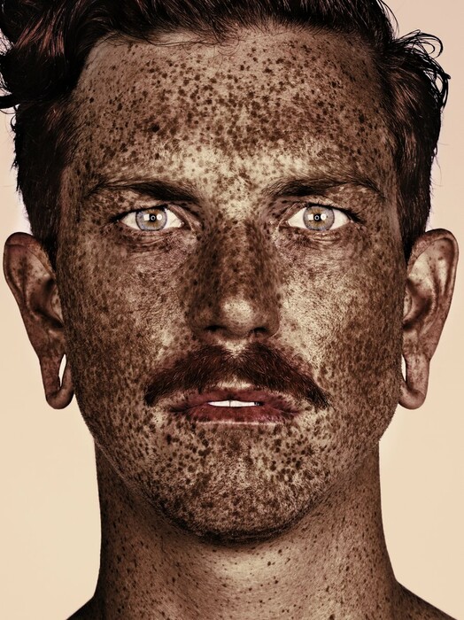 Η ομορφιά των ανθρώπων με φακίδες με τη ματιά του Brock Elbank