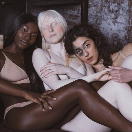 Imperfetta: «Ατελή» μοντέλα επαναπροσδιορίζουν την ομορφιά- Το Instagram που άλλαξε τη μόδα