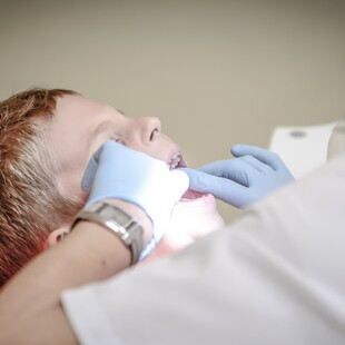 Dentist pass: Πότε ξεκινούν οι δωρεάν επισκέψεις σε οδοντίατρο