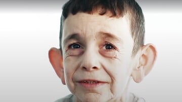 Αυτό το 7χρονο παιδί είναι παγιδευμένο στο σώμα ενός γέρου