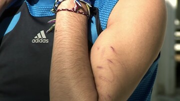 Ανθρωπιστική καταστροφή στο κέντρο προσφύγων της Σάμου
