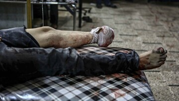 O Σύριος Mohammed Badra, καλύτερος φωτογράφος του 2016, καταγράφει τον πόλεμο από την πλευρά των θυμάτων