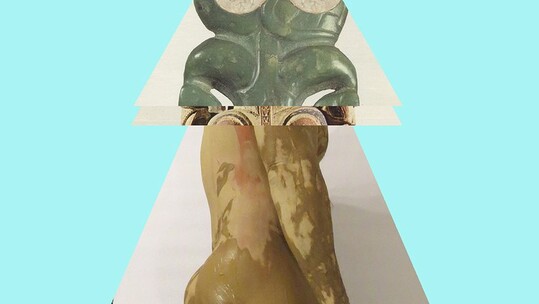 Atopic Bodies XI: Teen Atlas by HOPE
