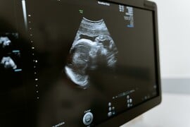 Έμεινε έγκυος με τη βοήθεια της τεχνητής νοημοσύνης - Προσπαθούσαν επί 18 χρόνια