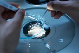 Καρκίνος: Σπάνιος τύπος παρουσιάζει απότομη αύξηση στις νεότερες ηλικίες