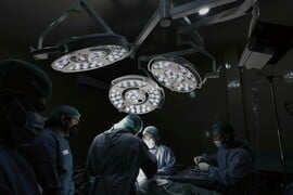 ΚΙΝΑ ΑΥΤΙ ΠΟΔΙ ΜΕΤΑΜΟΣΧΕΥΣΗ