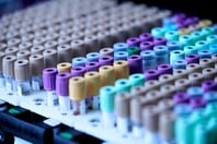 Πανεπιστήμιο Yale: Εξετάσεις αίματος θα μπορούσαν να προλάβουν υποτροπή του καρκίνου