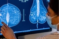 ΚΑΡΚΙΝΟΣ ΜΑΣΤΟΥ ΘΕΡΑΠΕΙΑ