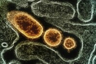 Γρίπη: Δεκάδες κρούσματα στα νοσοκομεία - Κυριαρχεί η υποπαραλλαγή Κ