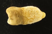 ΜΟΥΜΙΑ ΔΟΝΤΙ ΟΣΤΡΑΚΙΑ