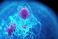 ΚΑΡΚΙΝΟΣ ΠΑΓΚΡΕΑΣ ΤΕΧΝΗΤΗ ΝΟΗΜΟΣΥΝΗ ΕΝΤΟΠΙΣΜΟΣ 