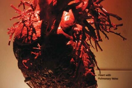 «BODIES»