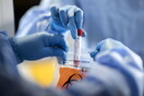 Κορωνοϊός: Τον Οκτώβριο τα πρώτα αποτελέσματα για το εμβόλιο του Ινστιτούτου Παστέρ