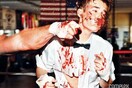 Τα δέκα χρόνια του Complex και ο Justin Bieber με μώλωπες